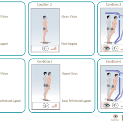 Gans sensory organization performance test