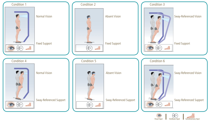 Gans sensory organization performance test